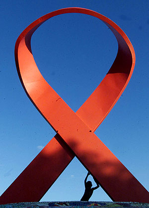 Tratamiento del SIDA y otras ETS en Madrid